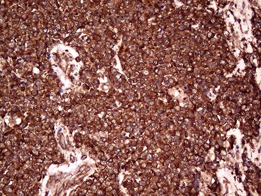 RPL10A Antibody (OTI2G9) Immunohistochemistry;RPL10A Antibody (OTI2G9)[NBP3-44967]-
