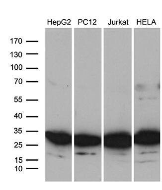 RPL10A Antibody (OTI2G9) Western Blot;RPL10A Antibody (OTI2G9)[NBP3-44967]-