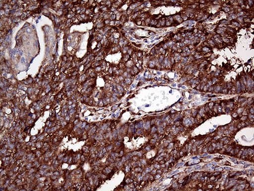 RPL10A Antibody (OTI4B2) Immunohistochemistry;RPL10A Antibody (OTI4B2)[NBP3-44968]-