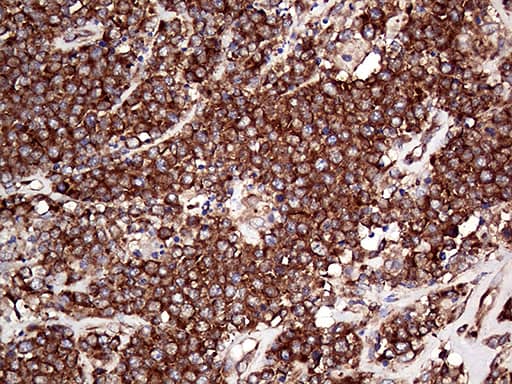 RPL10A Antibody (OTI4B2) Immunohistochemistry;RPL10A Antibody (OTI4B2)[NBP3-44968]-