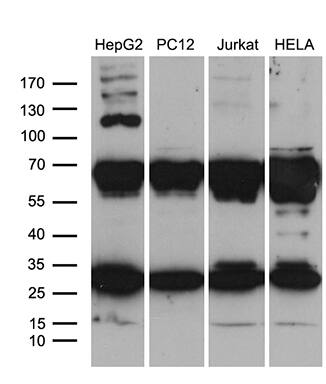 RPL10A Antibody (OTI4B2) Western Blot;RPL10A Antibody (OTI4B2)[NBP3-44968]-