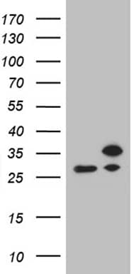 RPL10A Antibody (OTI4B2) Western Blot;RPL10A Antibody (OTI4B2)[NBP3-44968]-