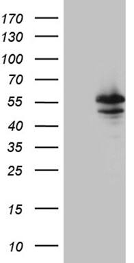 Myotilin Antibody (OTI8A7) Western Blot;Myotilin Antibody (OTI8A7)[NBP3-44972]-
