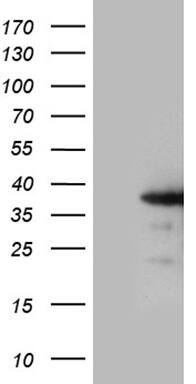 ZCCHC17 Antibody (OTI9A7) Western Blot;ZCCHC17 Antibody (OTI9A7)[NBP3-44973]-