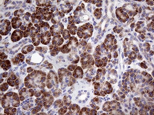 Myotilin Antibody (OTI5E11) Immunohistochemistry;Myotilin Antibody (OTI5E11)[NBP3-44982]-