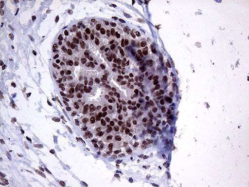 ZNF329 Antibody (OTI2B11) Immunohistochemistry;ZNF329 Antibody (OTI2B11)[NBP3-44986]-