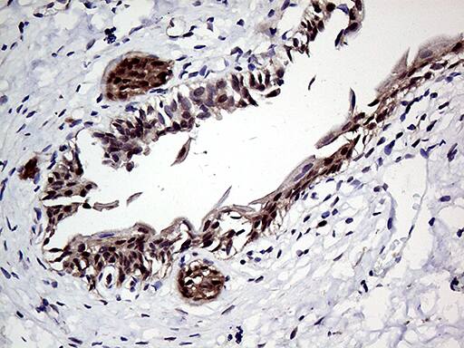 ZNF329 Antibody (OTI7F2) Immunohistochemistry;ZNF329 Antibody (OTI7F2)[NBP3-44987]-