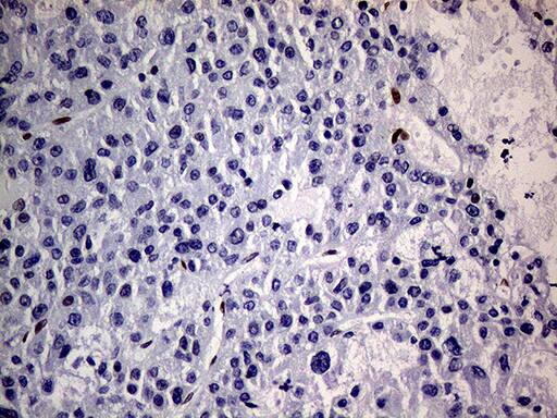 MEIS1 Antibody (OTI2A3)