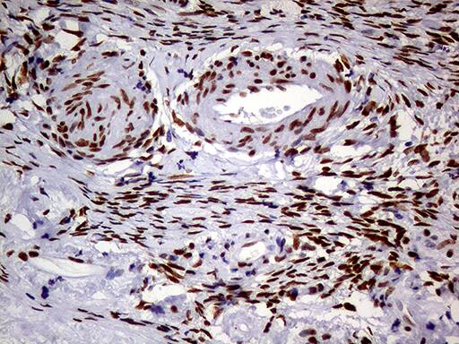 MEIS1 Antibody (OTI2A3)