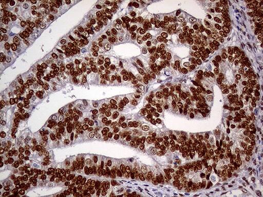 MEIS1 Antibody (OTI2A3)