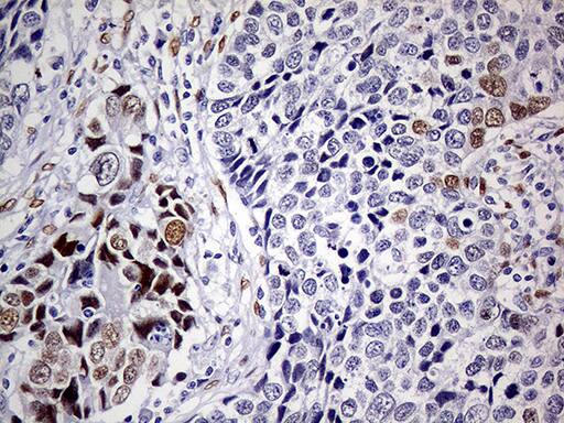 MEIS1 Antibody (OTI2A3)