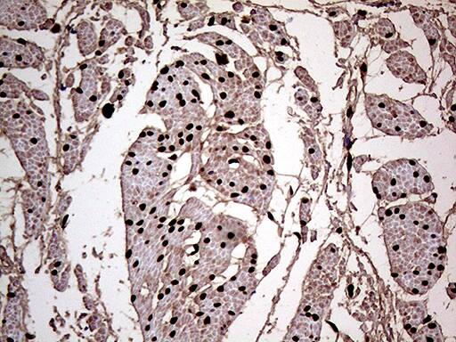 MEIS1 Antibody (OTI1B4)