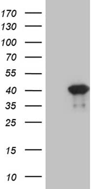 PITX2 Antibody (OTI1H10) Western Blot;PITX2 Antibody (OTI1H10)[NBP3-45000]-