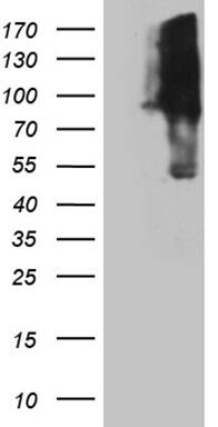 KIF9 Antibody (OTI1A2) Western Blot;KIF9 Antibody (OTI1A2)[NBP3-45004]-