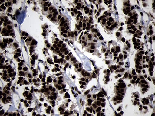 HOXC4 Antibody (OTI1F6)