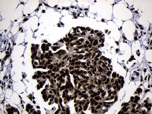 HOXC4 Antibody (OTI1F6) Immunohistochemistry;HOXC4 Antibody (OTI1F6)[NBP3-45006]-