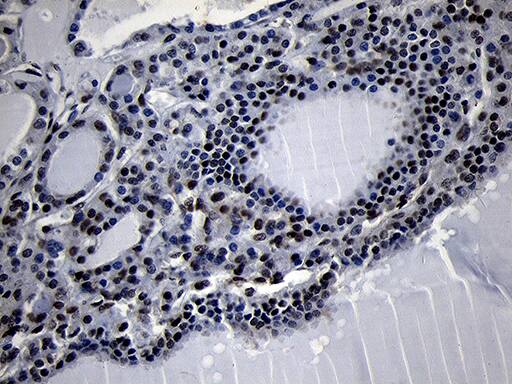 HOXC4 Antibody (OTI1F6) Immunohistochemistry;HOXC4 Antibody (OTI1F6)[NBP3-45006]-