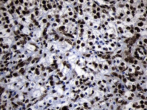 HOXC4 Antibody (OTI1F6) Immunohistochemistry;HOXC4 Antibody (OTI1F6)[NBP3-45006]-