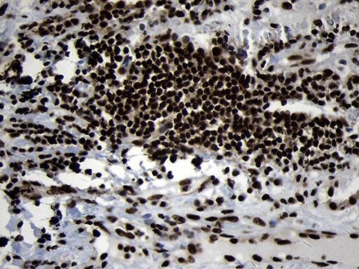HOXC4 Antibody (OTI1F6) Immunohistochemistry;HOXC4 Antibody (OTI1F6)[NBP3-45006]-