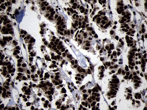 HOXC4 Antibody (OTI1F6) Immunohistochemistry;HOXC4 Antibody (OTI1F6)[NBP3-45006]-
