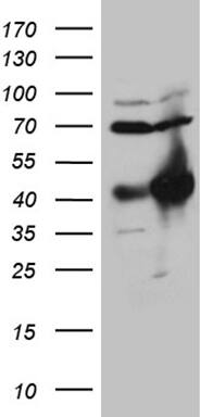 HOXC4 Antibody (OTI1F6) Western Blot;HOXC4 Antibody (OTI1F6)[NBP3-45006]-