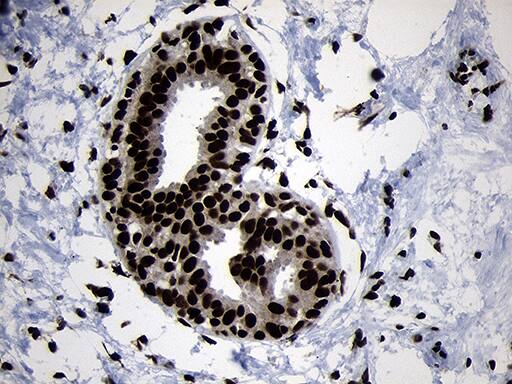 HOXC4 Antibody (OTI2D5) Immunohistochemistry;HOXC4 Antibody (OTI2D5)[NBP3-45009]-