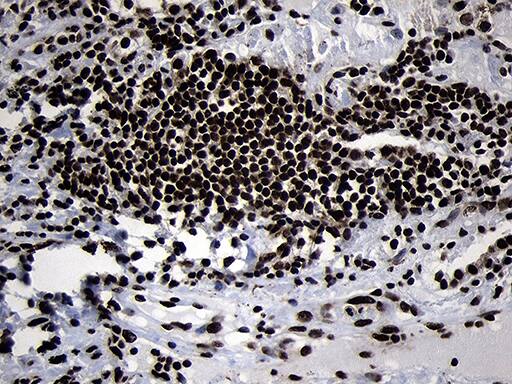 HOXC4 Antibody (OTI2D5) Immunohistochemistry;HOXC4 Antibody (OTI2D5)[NBP3-45009]-