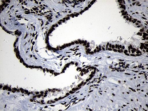 HOXC4 Antibody (OTI2D5) Immunohistochemistry;HOXC4 Antibody (OTI2D5)[NBP3-45009]-