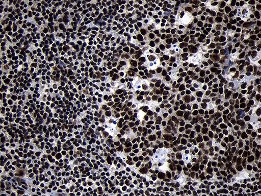 HOXC4 Antibody (OTI2D5) Immunohistochemistry;HOXC4 Antibody (OTI2D5)[NBP3-45009]-