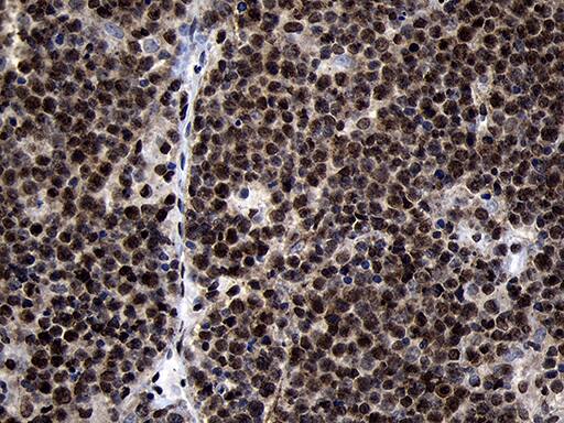 HOXC4 Antibody (OTI2D5) Immunohistochemistry;HOXC4 Antibody (OTI2D5)[NBP3-45009]-