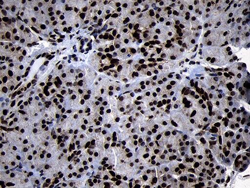 HOXC4 Antibody (OTI2D5) Immunohistochemistry;HOXC4 Antibody (OTI2D5)[NBP3-45009]-