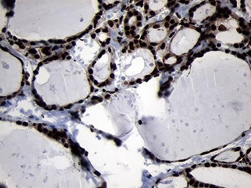 HOXC4 Antibody (OTI2D5) Immunohistochemistry;HOXC4 Antibody (OTI2D5)[NBP3-45009]-