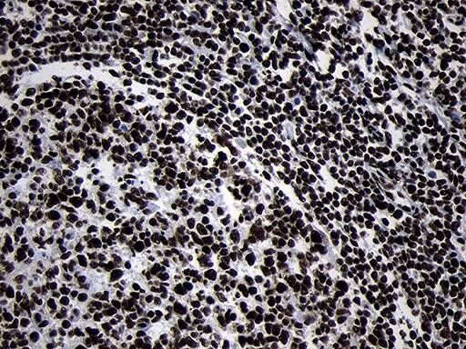 HOXC4 Antibody (OTI2D5) Immunohistochemistry;HOXC4 Antibody (OTI2D5)[NBP3-45009]-