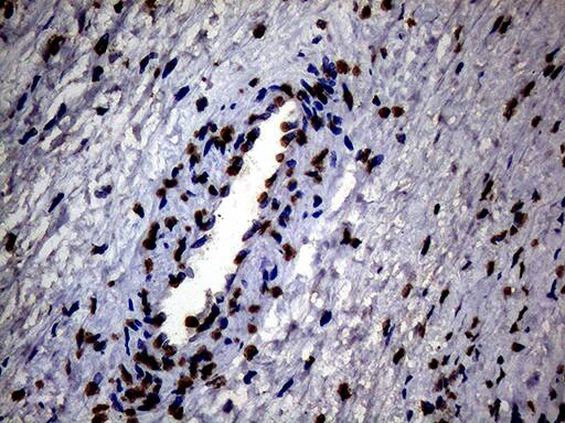 SH3BGRL Antibody (OTI8F7)