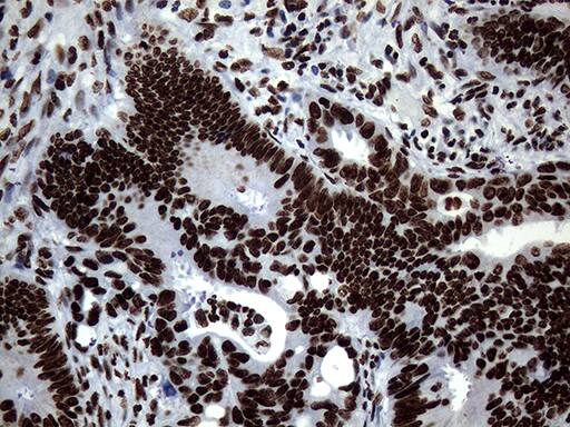 SH3BGRL Antibody (OTI8F7)