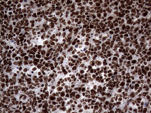 SH3BGRL Antibody (OTI8F7)