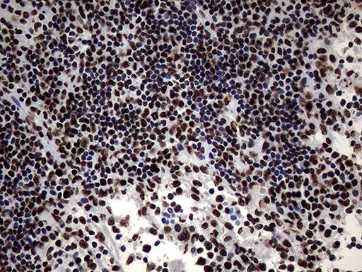 SH3BGRL Antibody (OTI8F7)