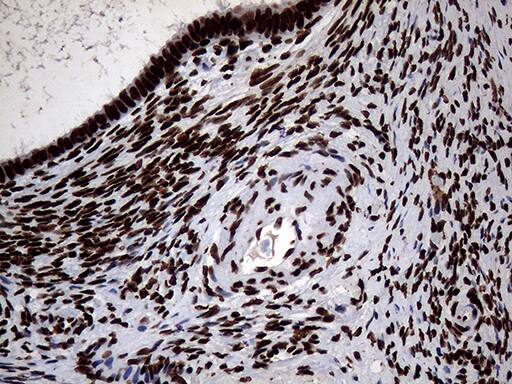 SH3BGRL Antibody (OTI8F7)