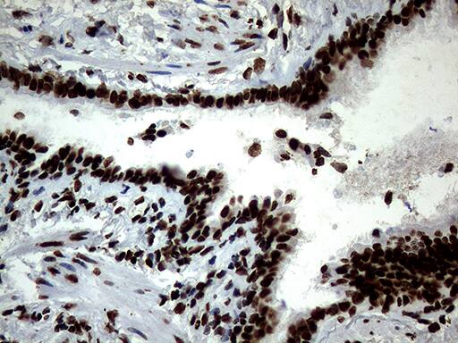 SH3BGRL Antibody (OTI8F7) Immunohistochemistry;SH3BGRL Antibody (OTI8F7)[NBP3-45012]-