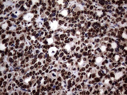 SH3BGRL Antibody (OTI8F7) Immunohistochemistry;SH3BGRL Antibody (OTI8F7)[NBP3-45012]-