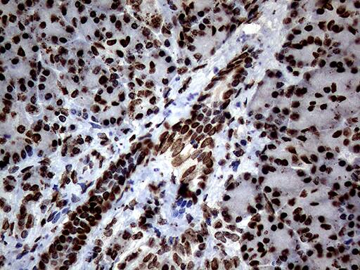SH3BGRL Antibody (OTI8F7) Immunohistochemistry;SH3BGRL Antibody (OTI8F7)[NBP3-45012]-