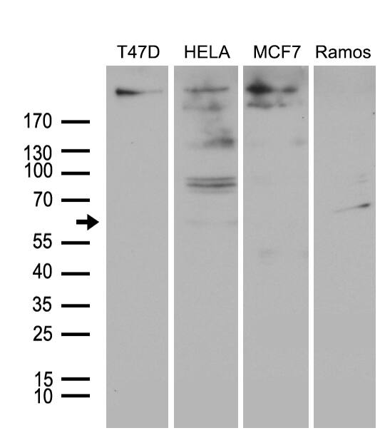 MTA3 Antibody (OTI2B8) Western Blot;MTA3 Antibody (OTI2B8)[NBP3-45015]-