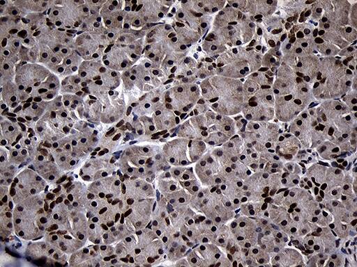 SUPT16H Antibody (OTI3B8) Immunohistochemistry;SUPT16H Antibody (OTI3B8)[NBP3-45016]-
