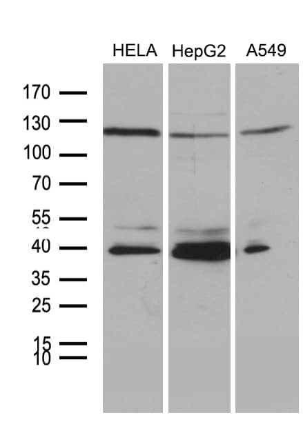 PHF20L1 Antibody (OTI6G6)