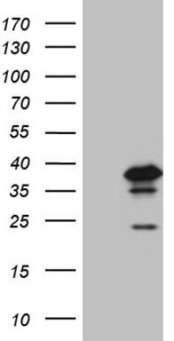 PHF20L1 Antibody (OTI6G6) Western Blot;PHF20L1 Antibody (OTI6G6)[NBP3-45020]-