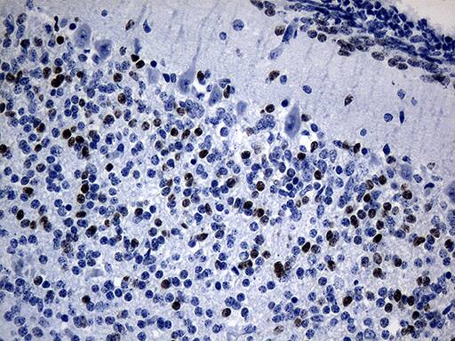 PHF20L1 Antibody (OTI1F4) Immunohistochemistry;PHF20L1 Antibody (OTI1F4)[NBP3-45021]-
