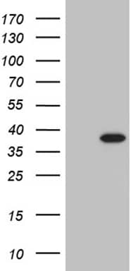 PHF20L1 Antibody (OTI1F4)
