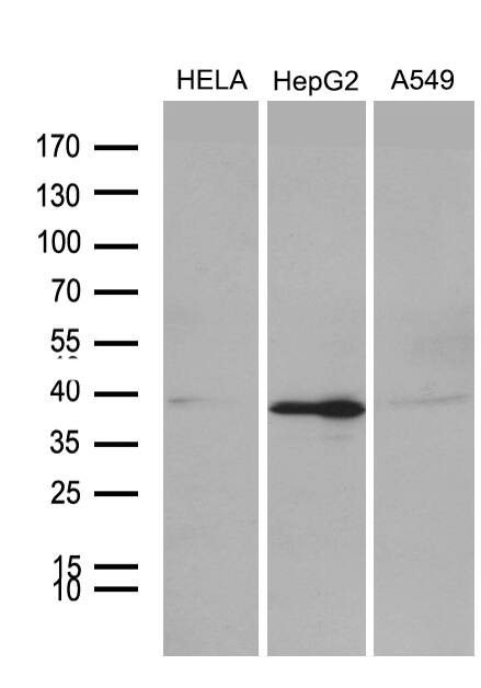 PHF20L1 Antibody (OTI1F4) Western Blot;PHF20L1 Antibody (OTI1F4)[NBP3-45021]-