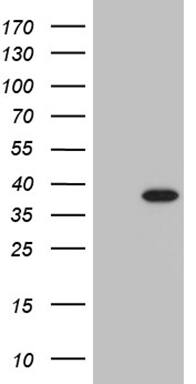PHF20L1 Antibody (OTI1F4) Western Blot;PHF20L1 Antibody (OTI1F4)[NBP3-45021]-