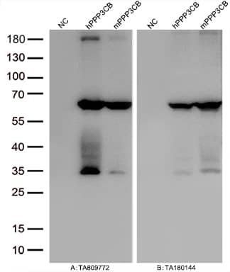 PPP3CB Antibody (OTI2E4)